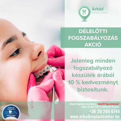 Délelőtti Fogszabályozás AKCIÓ