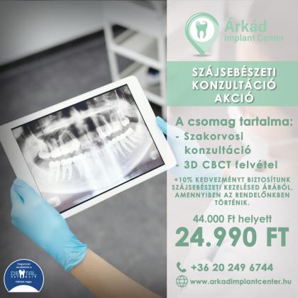 Szájsebészeti konzultációs csomag