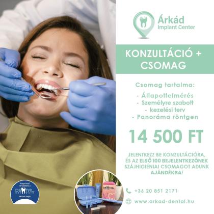 Konzultáció+ csomag Konzultáció+ csomag