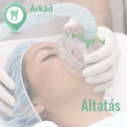 Altatás (Kizárólag az Árkád Dentalban és a Bartók Dentalban érhető el) 