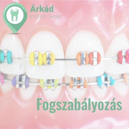 Fogszabályozás - szabályos fogsor