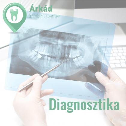 Diagnosztika - fogászati szűrés